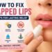 How to fix chapped lips with a simple lip barrier repair routine